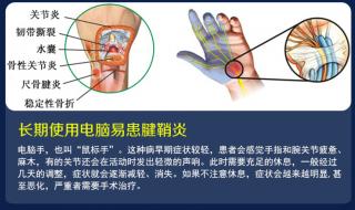 医院白色腕带代表什么